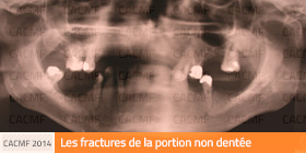 Fractures de la portion non dentée
